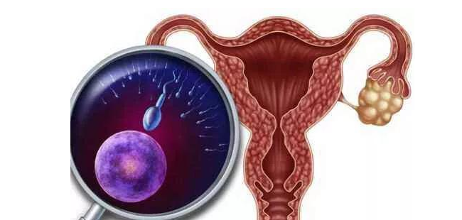 探索子宫肌腺症背的因及预防方法
